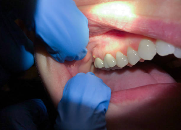 Best After-Hours Emergency Dentist in Iowa Colony, TX