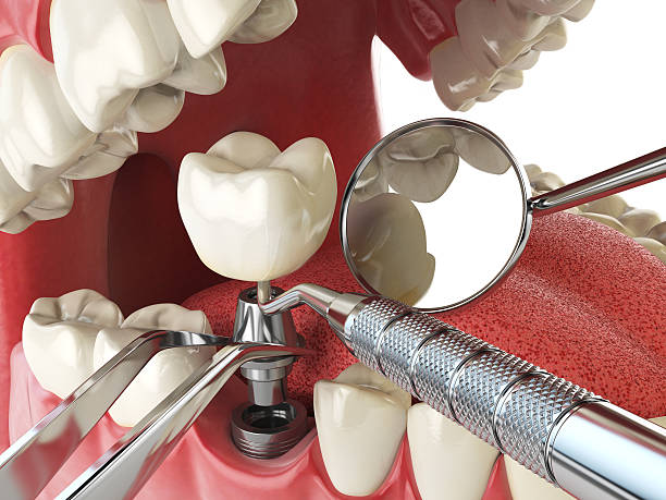 Best Emergency Dental Surgery in Iowa Colony, TX