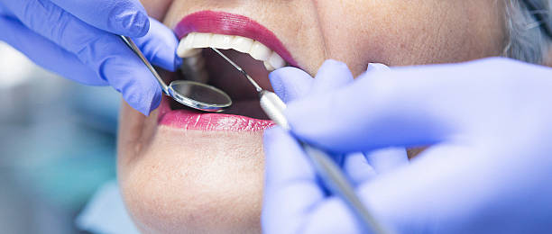 Best Emergency Tooth Extraction in Iowa Colony, TX
